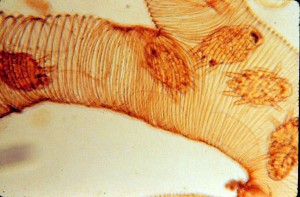 Tracheal_mite_-_Acarapis_woodi